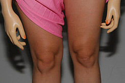 Knees and Hands